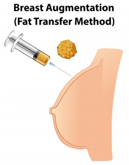 Breast augmentation by fat transfer surgery in Bangalore