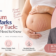Postpartum Stretch Marks and Tummy Tuck: What Mothers Need to Know